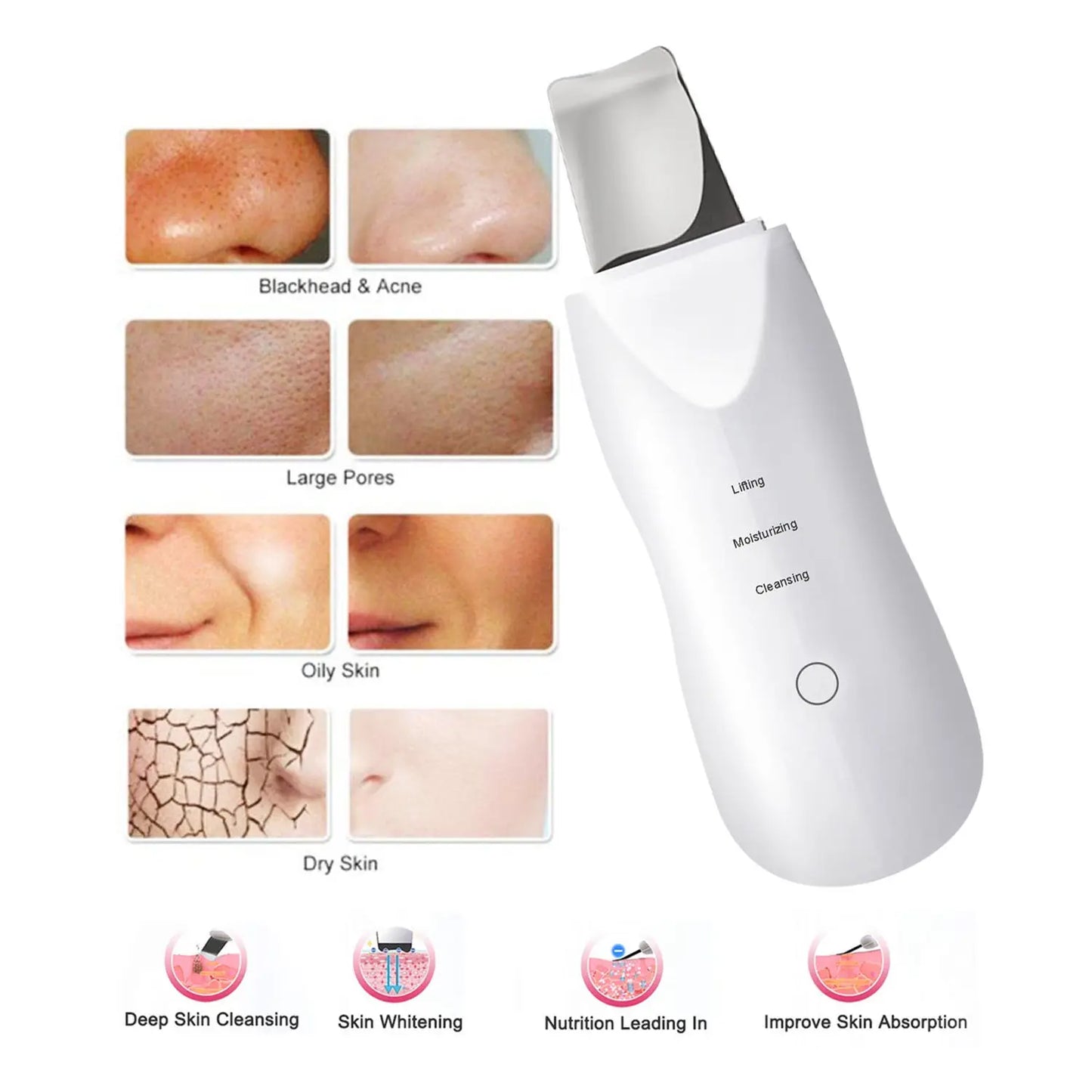 Ultrasonic Facial Skin Scrubber