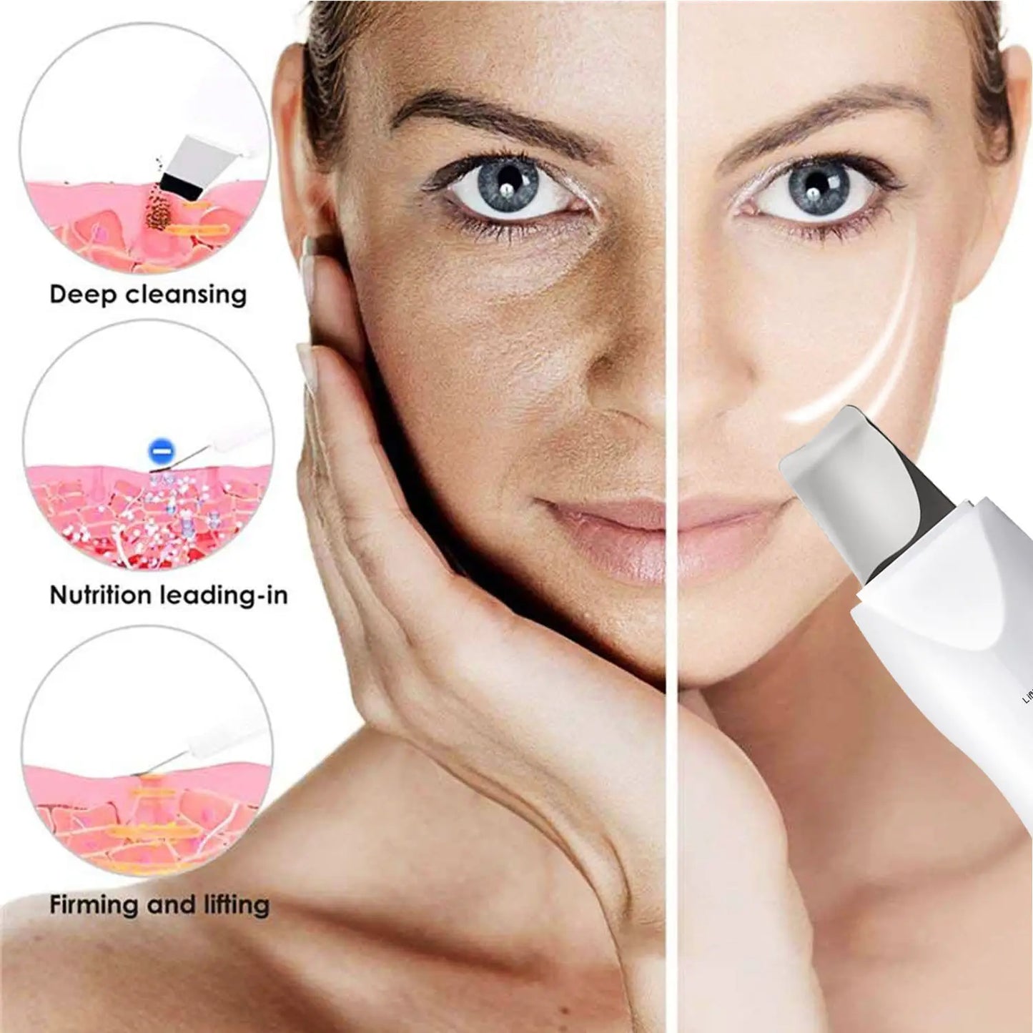Ultrasonic Facial Skin Scrubber